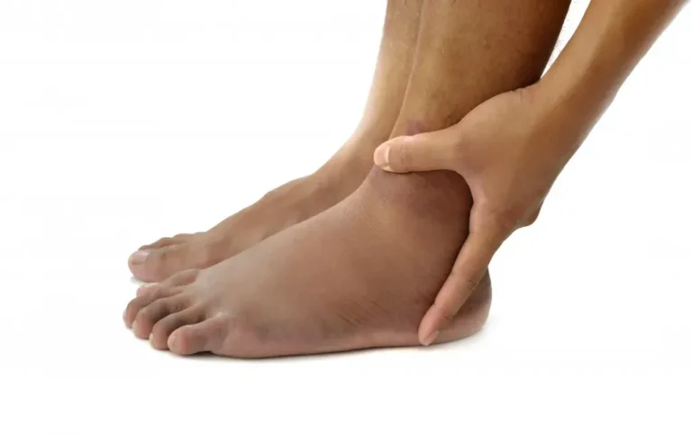 How to Prevent Ankle Instability After a Sprain