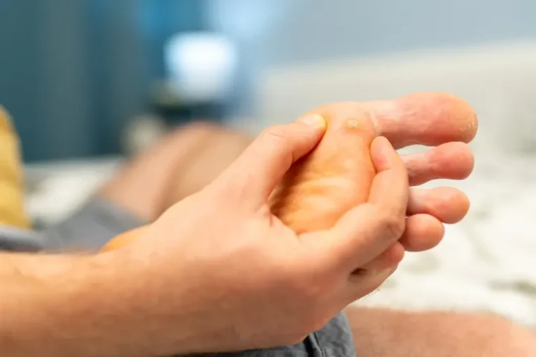 Why You Shouldn’t Remove a Plantar Wart Yourself