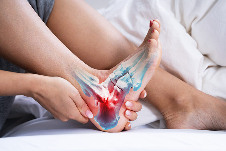 Tendonitis anyone?